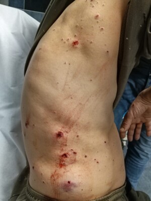 اصابة شخص في منطقة برج البراجنة جراء سقوط قذيفة الـB7 اثر اشكال في حي السلم