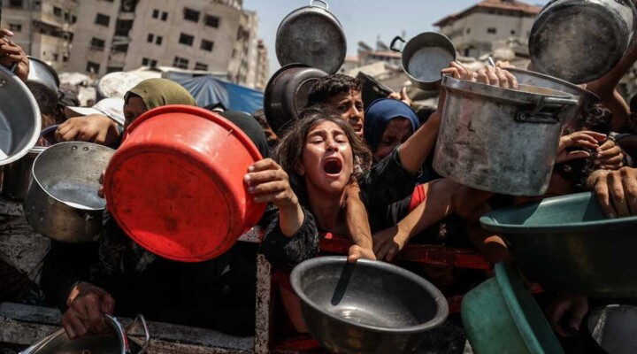 "أوتشا": تشخيص نحو 28 ألف حالة سوء تغذية حاد بين أطفال غزة خلال تموز وآب